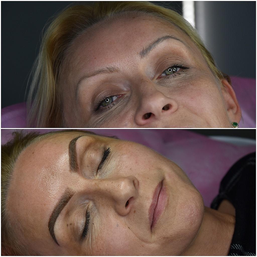 Zdjęcie przedstawia efekt przed i po zabiegu mikropigmentacji brwi u kobiety o jasnej karnacji i blond włosach; widoczne subtelne różnice w kształcie i kolorze brwi.