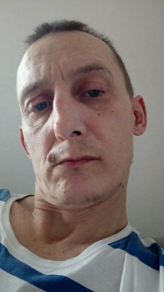 Portret mężczyzny z bliska, ubrany w koszulkę w paski. Widoczne zmarszczki i znamiona na twarzy, oświetlenie naturalne.