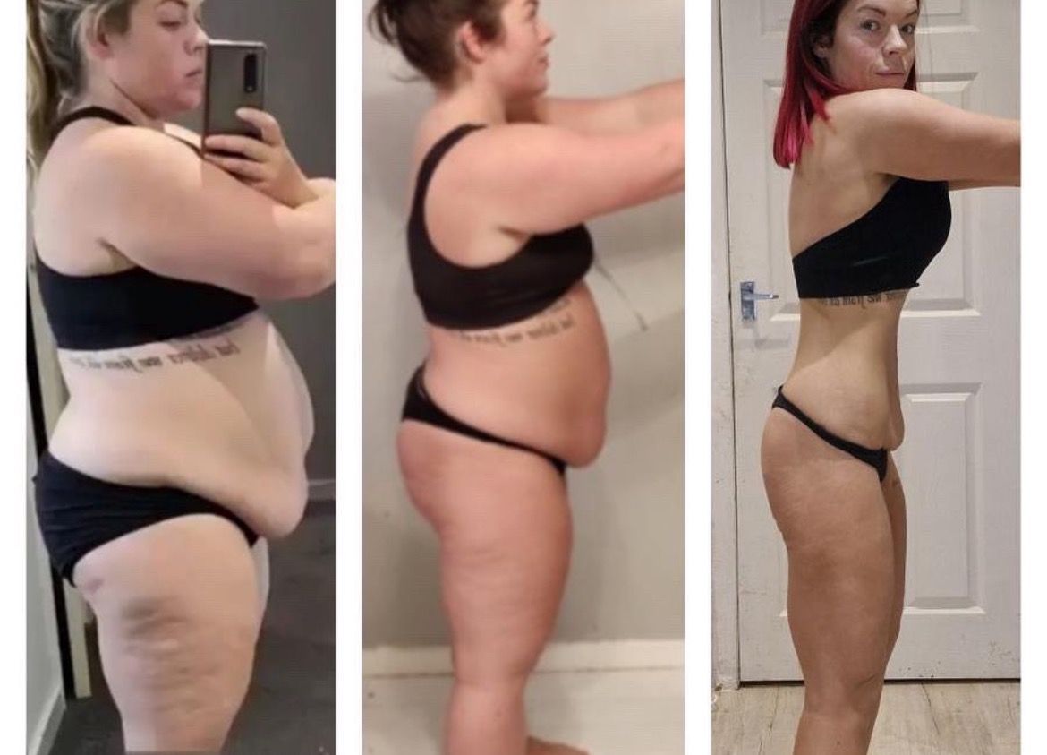 Zdjęcie typu 'przed i po' przedstawia metamorfozę sylwetki kobiety w czarnej bieliźnie. Widoczne zmiany w obwodzie brzucha i ud. Po prawej stronie kobieta z czerwonymi włosami.