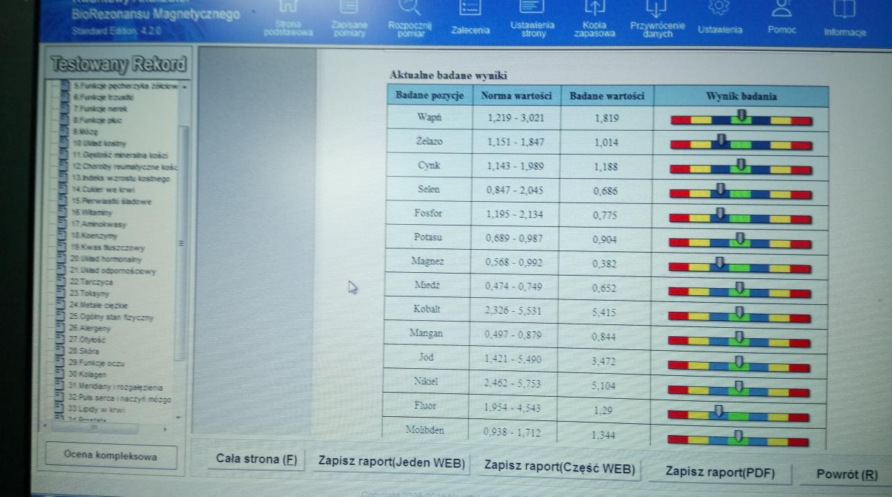 Ekran monitora prezentujący wyniki analizy pierwiastków i minerałów w organizmie za pomocą urządzenia do biorezonansu magnetycznego; widoczne tabele z normami i badanymi wartościami.