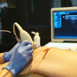 Badanie USG kolana z widocznym obrazem na monitorze, elektrodą i żelem.