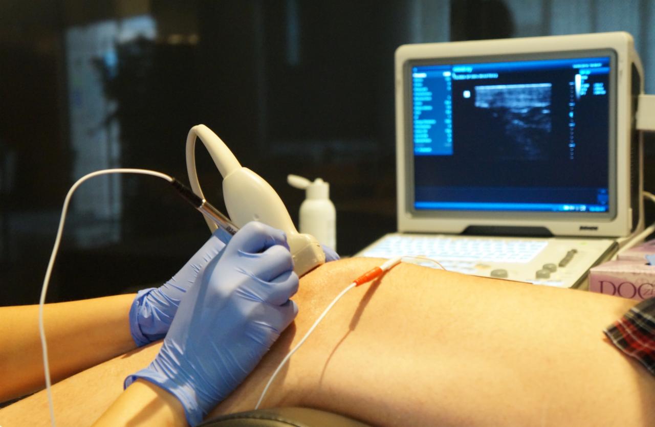 Badanie USG kolana z widocznym obrazem na monitorze, elektrodą i żelem.