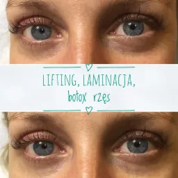 Zbliżenie na oczy kobiety przed i po zabiegu liftingu, laminacji i botoksu rzęs, prezentujące różnicę w ich wyglądzie.