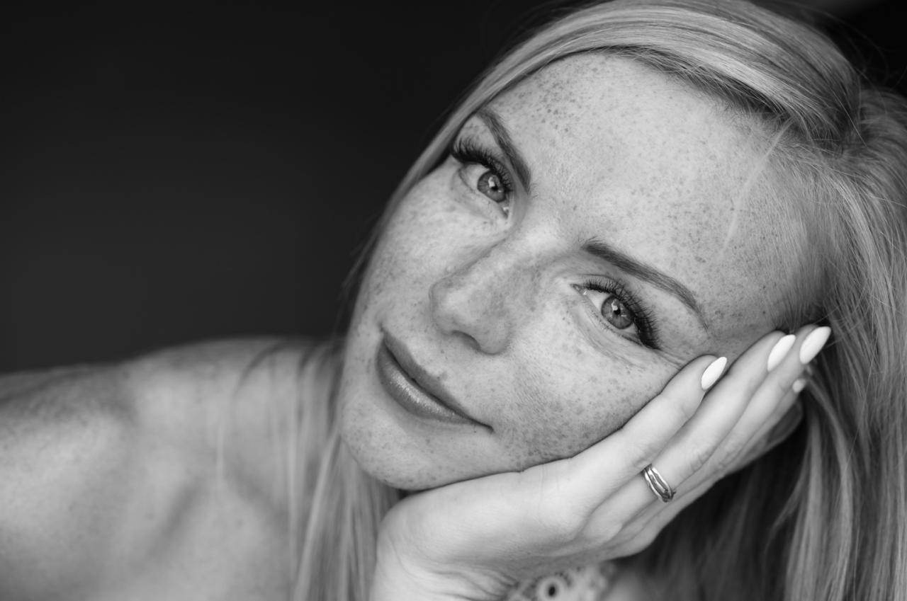 Portret kobiety z piegami, opierającej policzek na dłoni z pierścionkiem, czarno-białe zdjęcie.