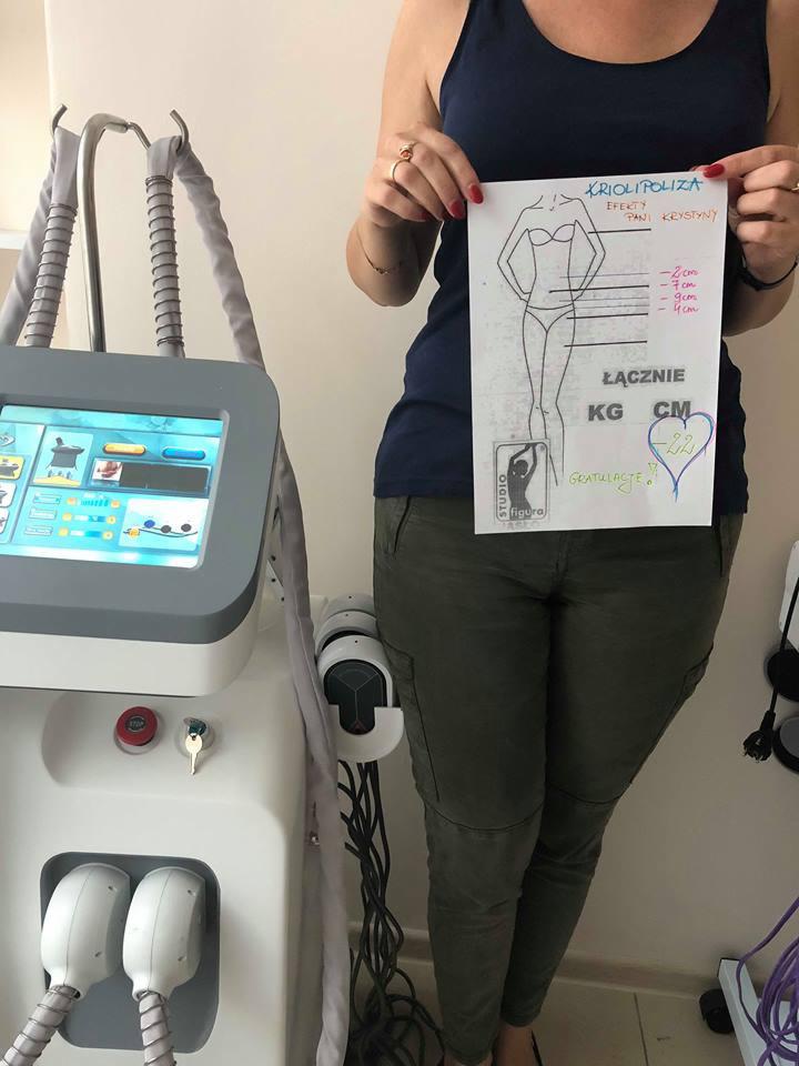 Kriolipoliza -wymrażanie tkanki tłuszczowej