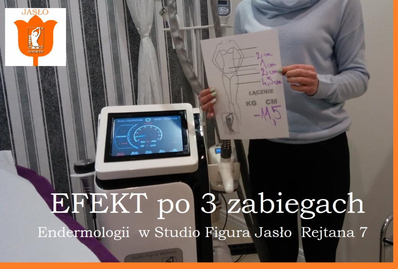 Kobieta prezentuje kartkę z odręcznymi pomiarami ciała i schematem sylwetki, wskazując na zmniejszenie obwodów po trzech zabiegach endermologii, obok widoczny sprzęt do modelowania sylwetki...