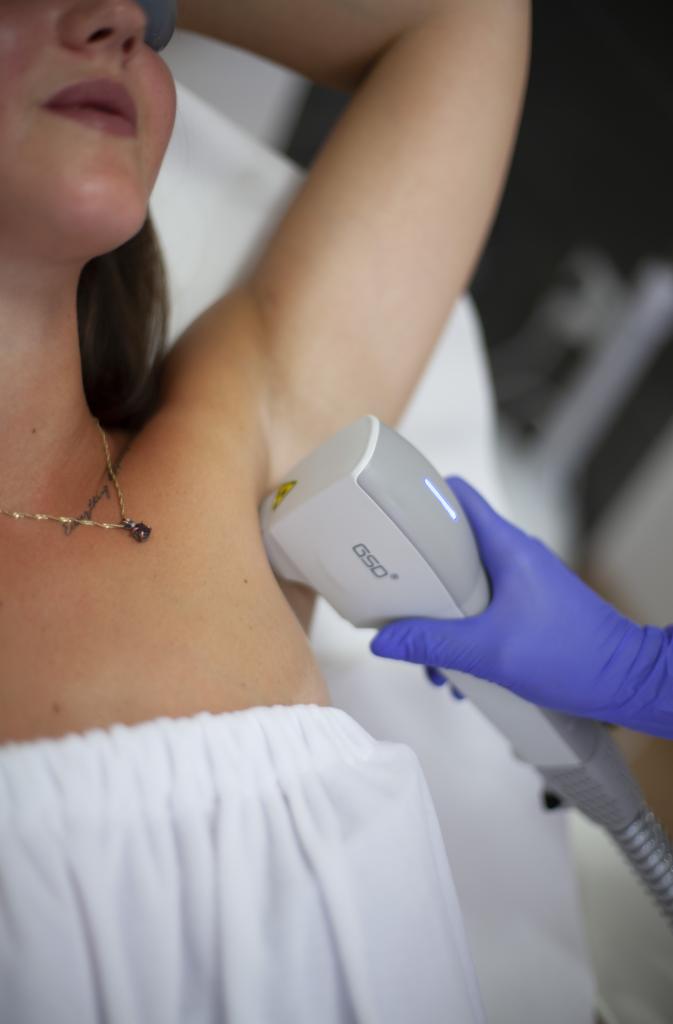 Depilacja laserowa pachy wykonywana przez osobę w niebieskich rękawiczkach, widoczny laser GSD, pacjentka z łańcuszkiem na szyi i osłoną na oczach leży na białym prześcieradle.