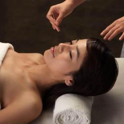 Akupunktura estetyczna