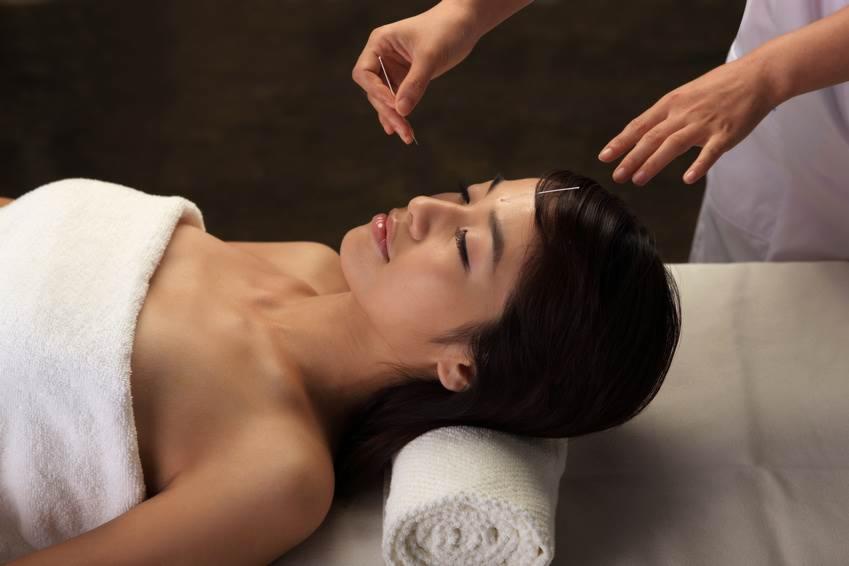 Akupunktura estetyczna