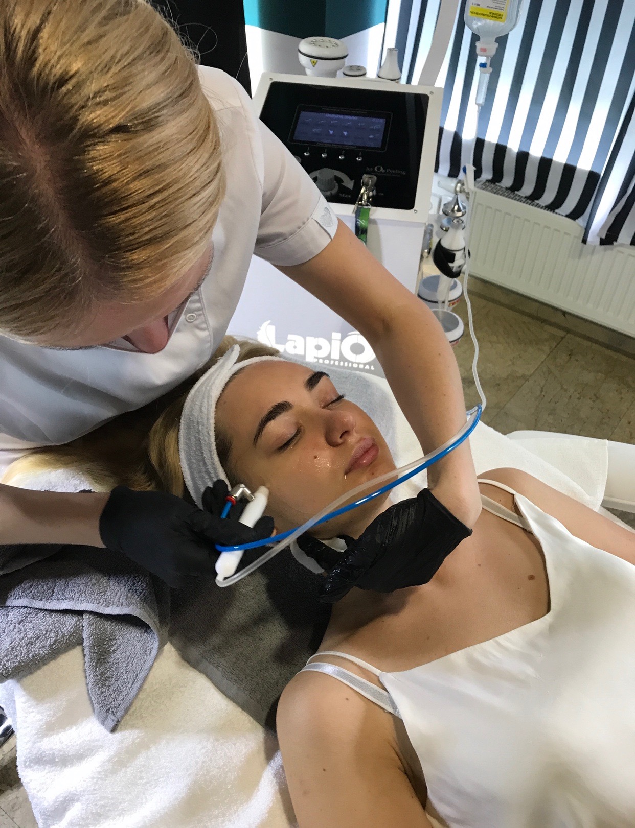 Oxybrazja + peeling kawitacyjny - 150