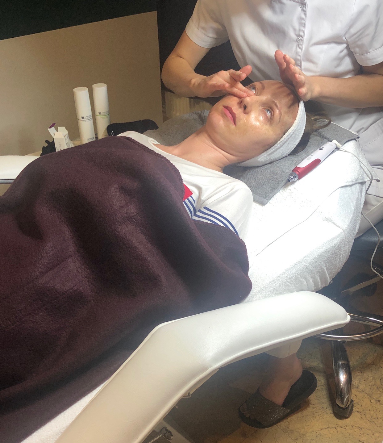 Peeling chemiczny - 100