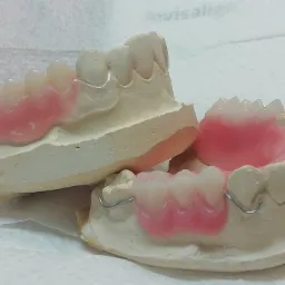 Dwie częściowo dopasowane protezy szkieletowe na modelach gipsowych, widoczne metalowe klamry i różowe płyty protez.