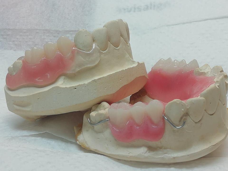 Dwie częściowo dopasowane protezy szkieletowe na modelach gipsowych, widoczne metalowe klamry i różowe płyty protez.