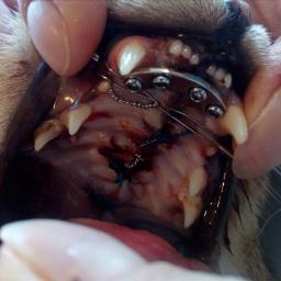 OSTEOSYNTEZA - REKONSTRUKCJA SZCZĘKI PO ROZLEGŁYM URAZIE KOMUNIKACYJNYM