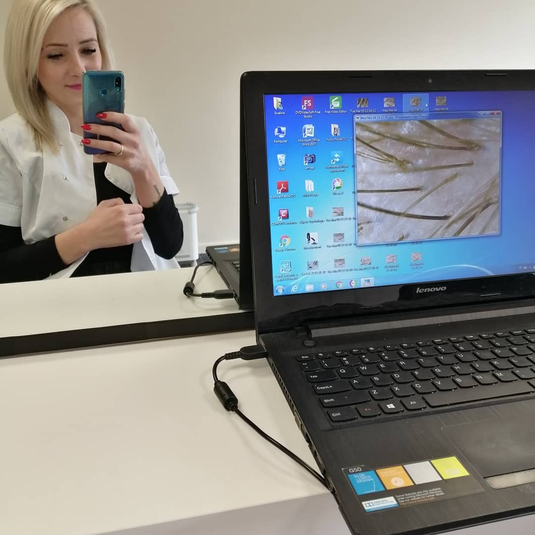 Kobieta w białym fartuchu robi selfie telefonem, w tle laptop z otwartym programem pokazującym powiększone włosy i skórę głowy.