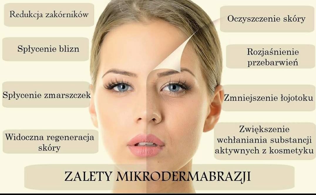 Grafika przedstawia porównanie skóry przed i po zabiegu mikrodermabrazji, z opisem korzyści takich jak redukcja zakórników, spłycenie blizn i zmarszczek, rozjaśnienie przebarwień, oczyszczenie...