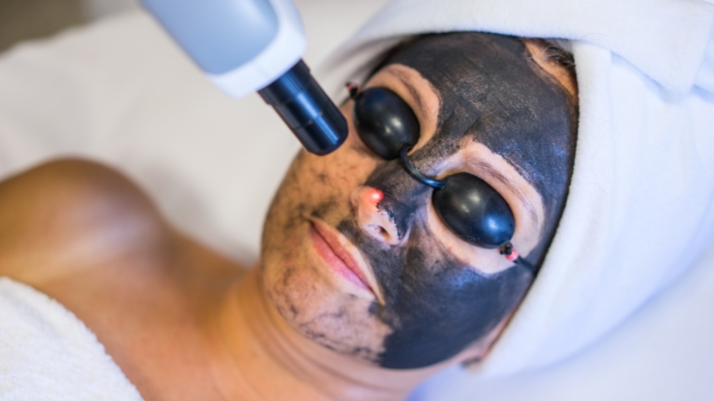 Kobieta z maską węglową na twarzy i ochronnymi okularami podczas zabiegu laserowego w salonie kosmetycznym, widoczny czerwony punkt lasera na nosie.