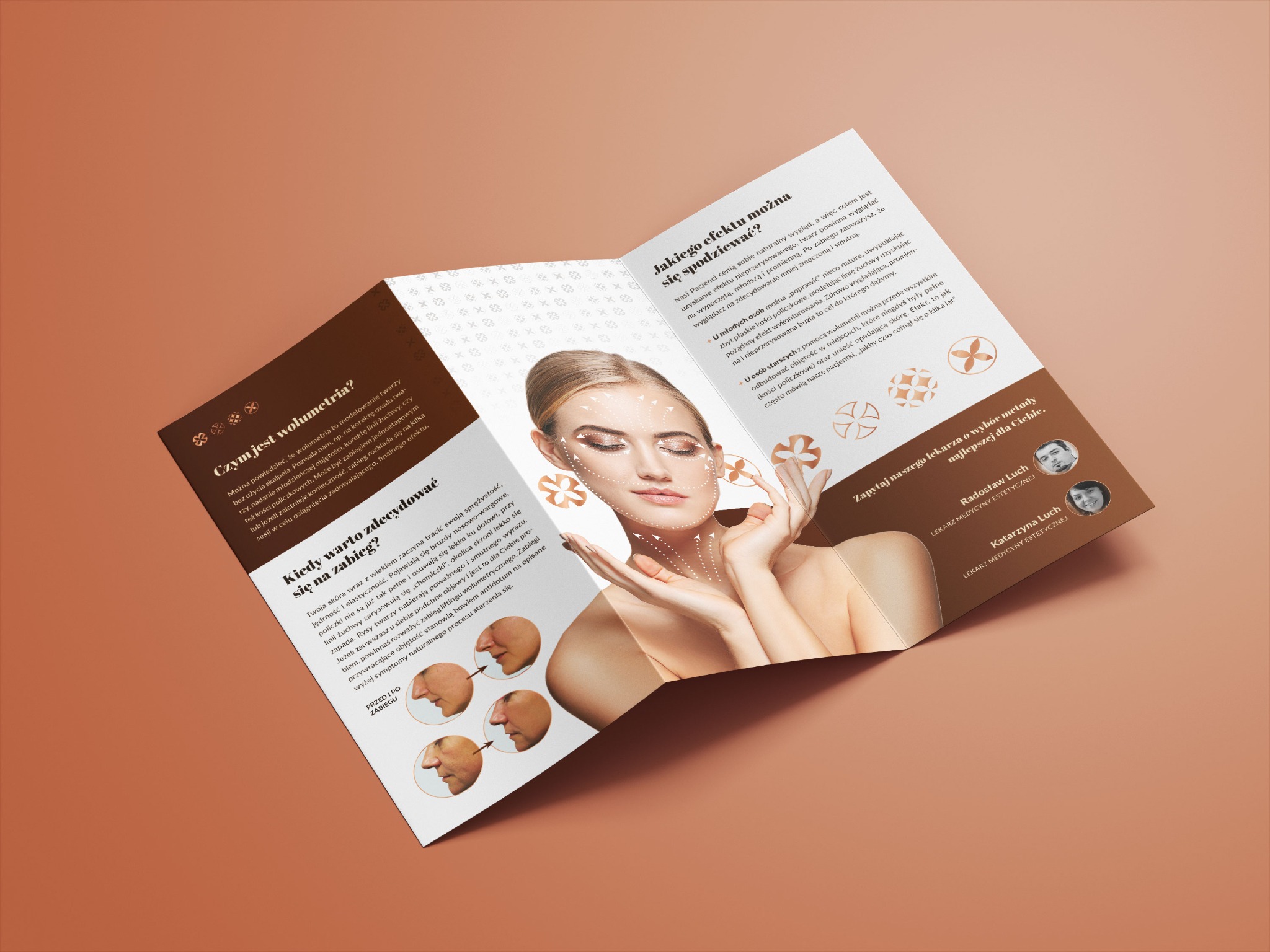 Ulotka reklamowa zabiegu wolumetrii twarzy, prezentująca efekty przed i po zabiegu, z zaznaczonymi strzałkami obszarami modelowania na twarzy modelki.