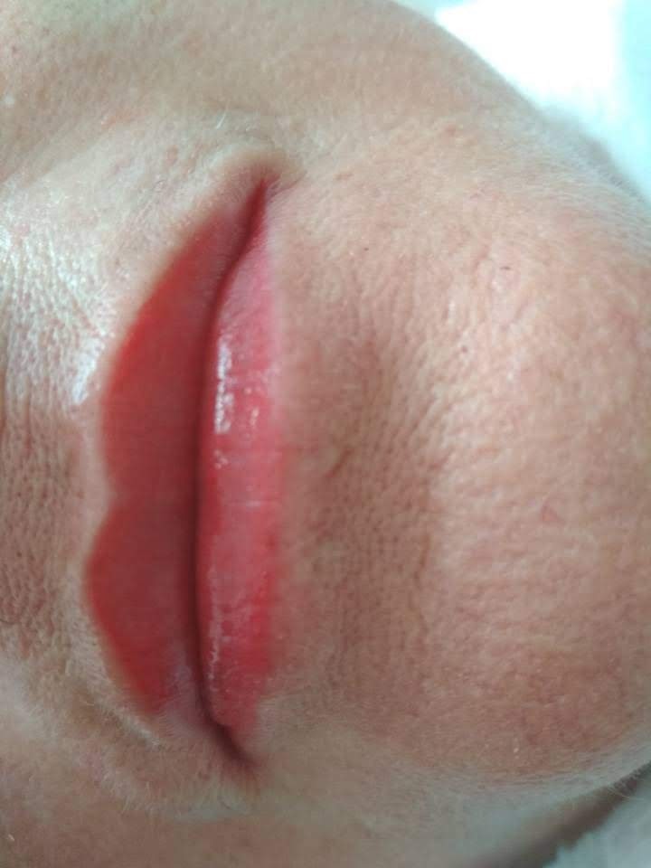 Zbliżenie na usta po zabiegu makijażu permanentnego; widoczne zaczerwienienie skóry wokół ust i intensywny kolor pigmentu.