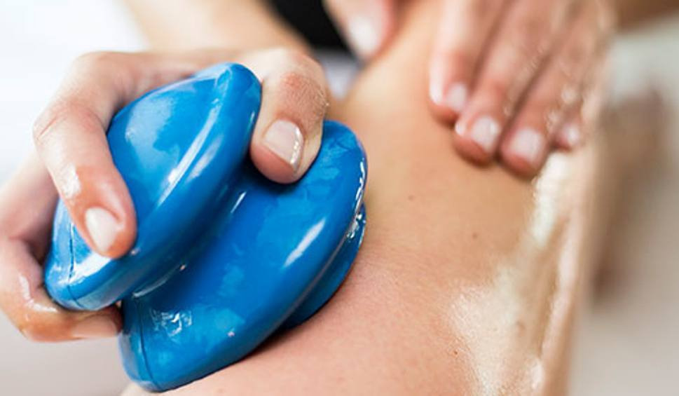 Dłonie fizjoterapeuty przesuwają poolejoną skórze pacjenta niebieski bańki do masażu próżniowego.