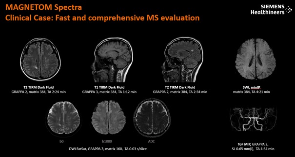 Zestawienie obrazów MRI głowy z różnymi sekwencjami (T1, T2, SWI, DWI, ToF MIP) oraz parametrami akwizycji, prezentujące diagnostykę neurologiczną.
