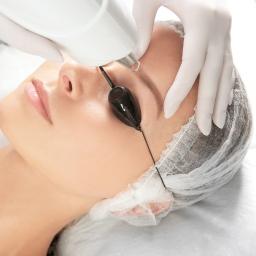 Laserowe usuwanie makijażu permanentnego - laserem pikosekundowym.