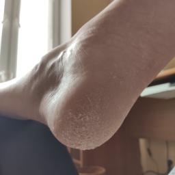 Wygładzanie podeszwy stopy!