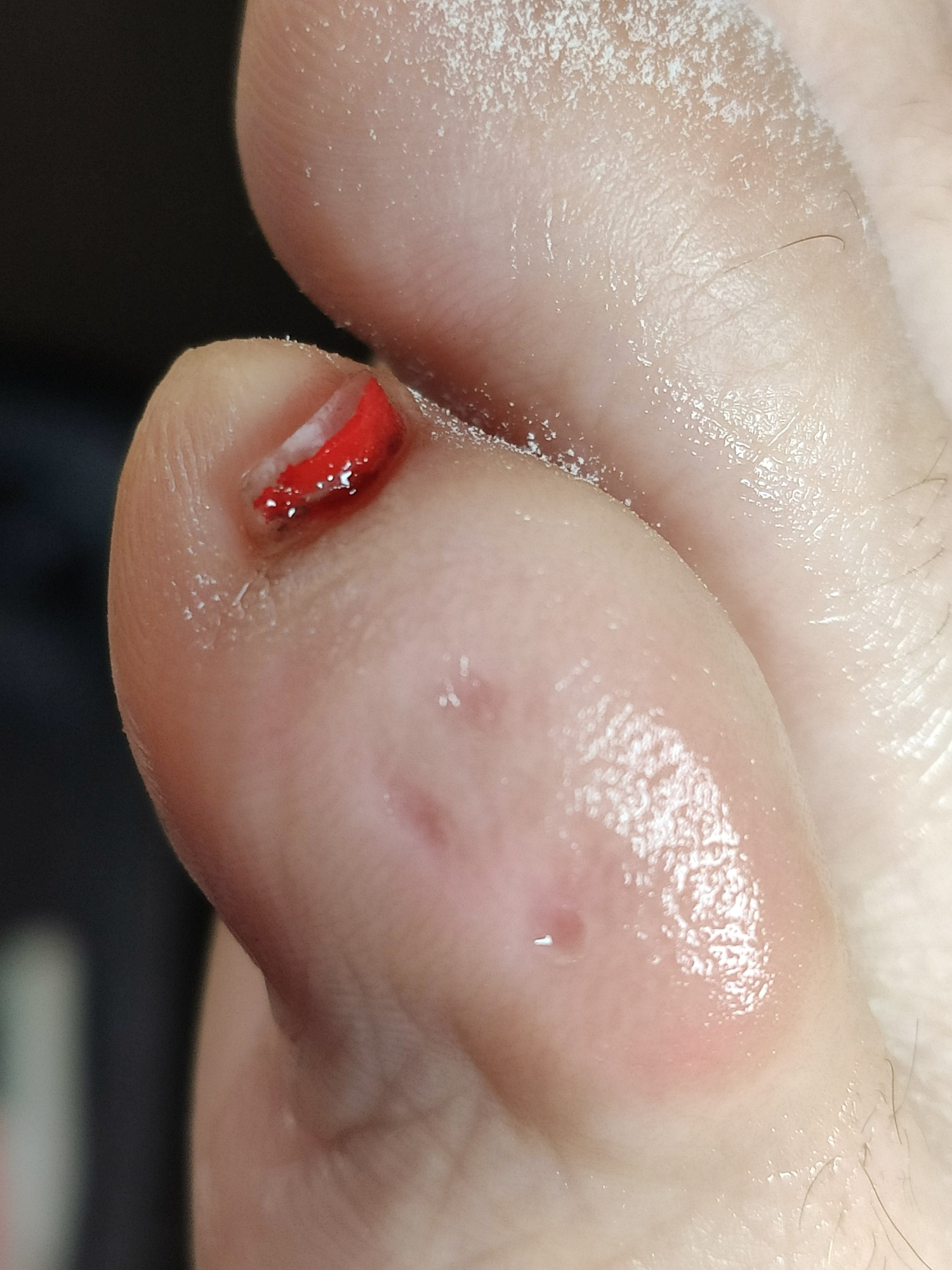 Efekt po usunięciu odcisku!