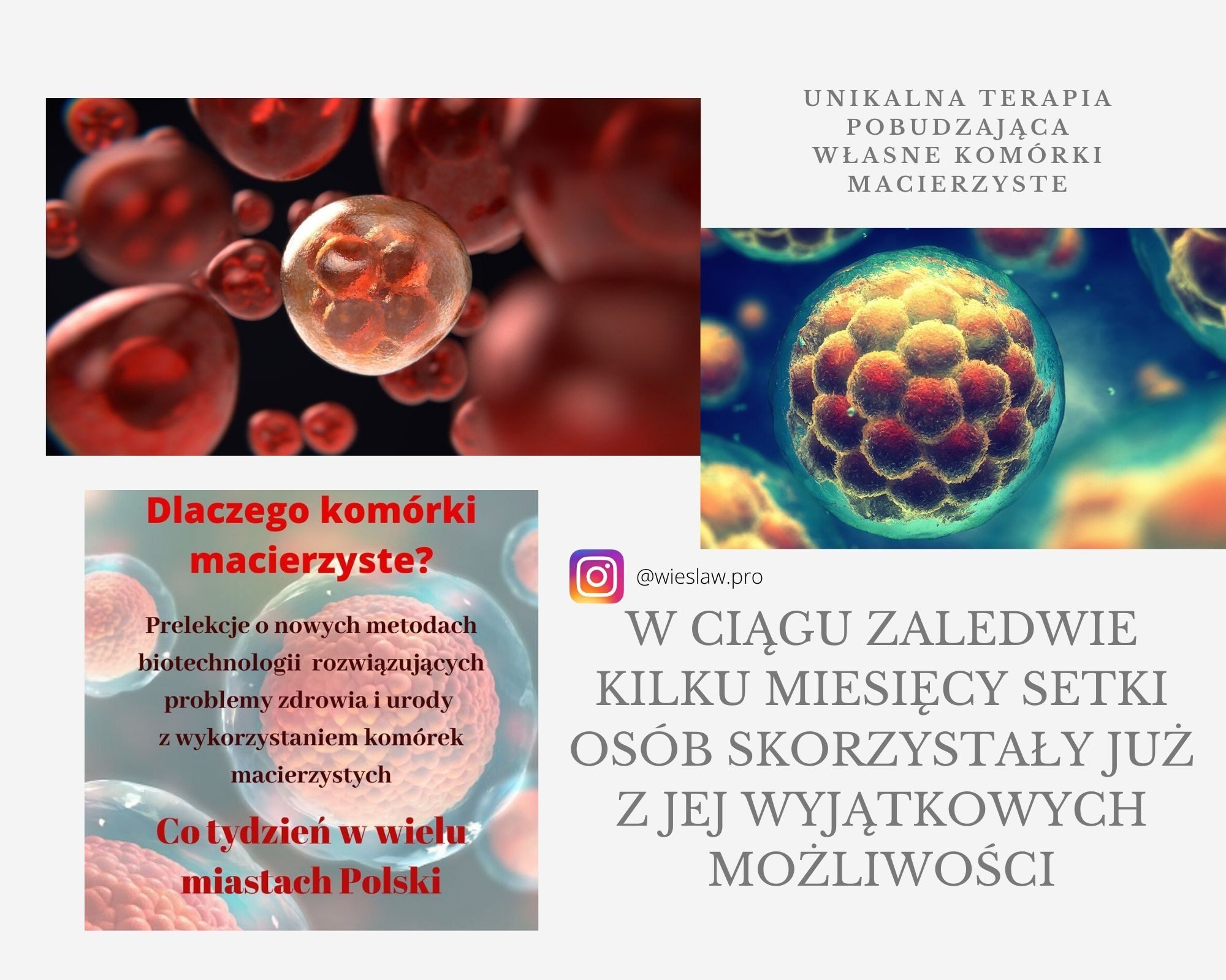 Grafika informacyjna o terapii komórkami macierzystymi, prezentująca wizualizacje komórek oraz tekst o unikalnej terapii i prelekcjach na temat biotechnologii.