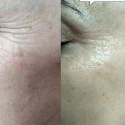 Medycyna estetyczna Pińczów 4