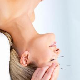 Akupunktura kosmetyczna - Medycyna Alternatywna Wałbrzych
