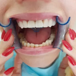 Most góra na cyrkonie.