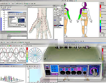 Oprogramowanie diagnostyczne z interfejsem przedstawiającym punkty na dłoni, mapę ciała z oznaczonymi strefami oraz wykresy i analizy danych.