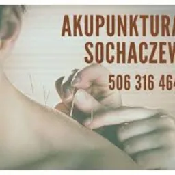 Zbliżenie na ramię z wbitymi igłami, napis 'Akupunktura Sochaczew' i numer telefonu. Widoczne dłonie osoby wykonującej zabieg.