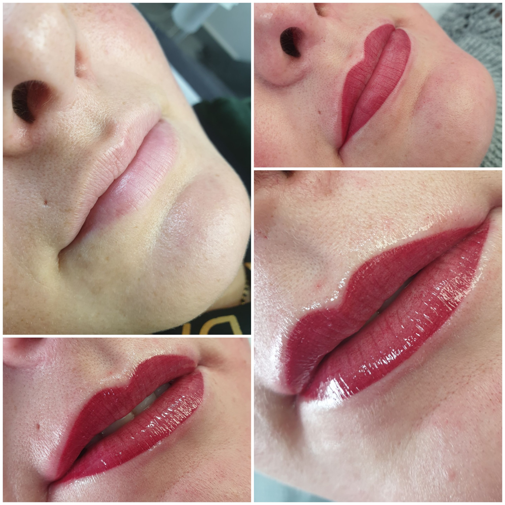 Zbliżenie na usta kobiety w trakcie zabiegu pigmentacji; widoczne etapy: przed zabiegiem, kontur i pełne wypełnienie kolorem; efekt połysku.
