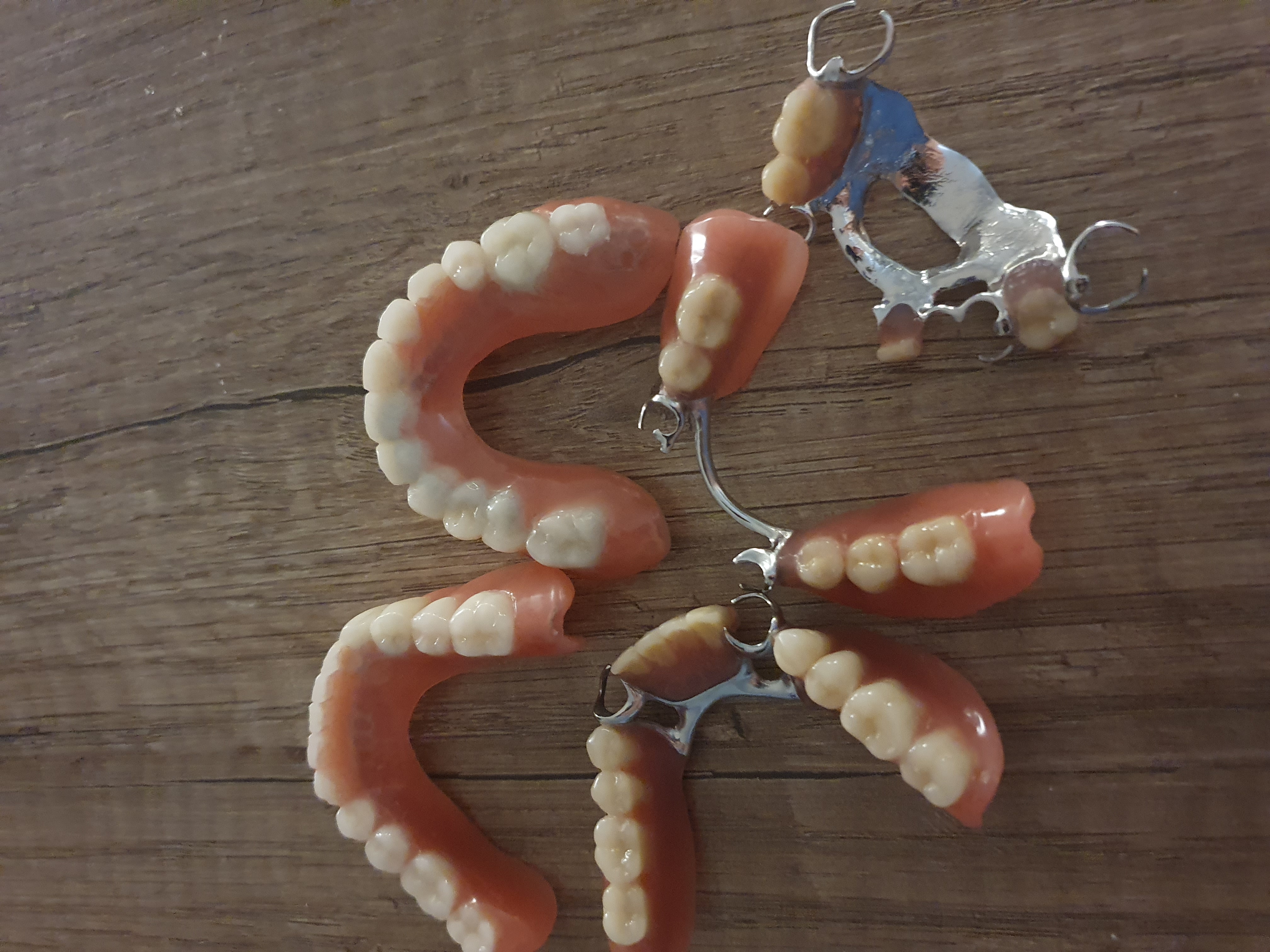 Różne protezy dentystyczne częściowe, w tym proteza szkieletowa z metalowymi klamrami, ułożone na drewnianej powierzchni.