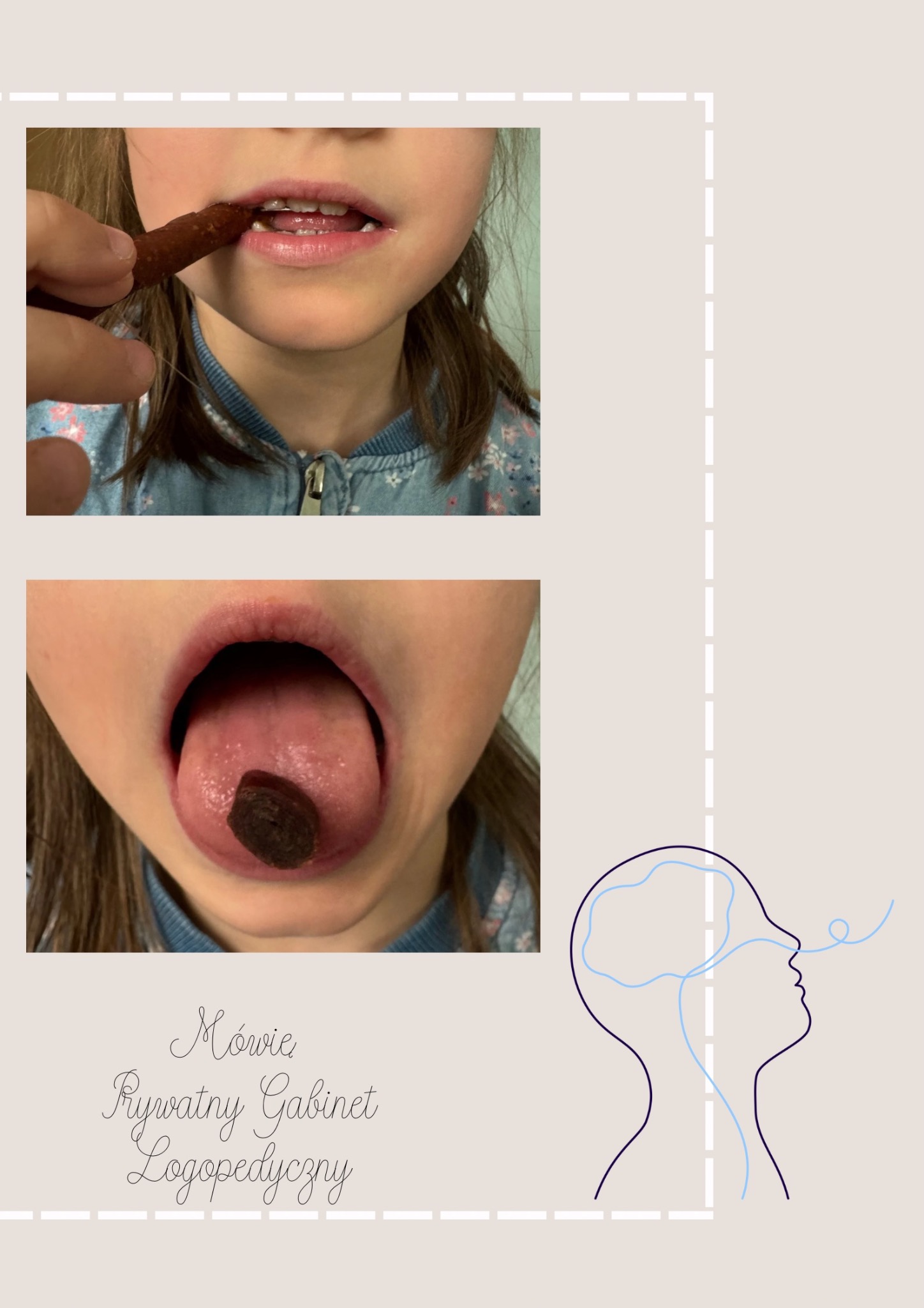 Ćwiczenia artykulacyjne dziecka z użyciem smakołyków, mające na celu poprawę mowy, widoczne szczegóły w jamie ustnej.