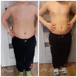 Porównanie sylwetki chłopca przed i po 21 dniach: widoczna redukcja tkanki tłuszczowej na brzuchu i poprawa ogólnej kondycji.