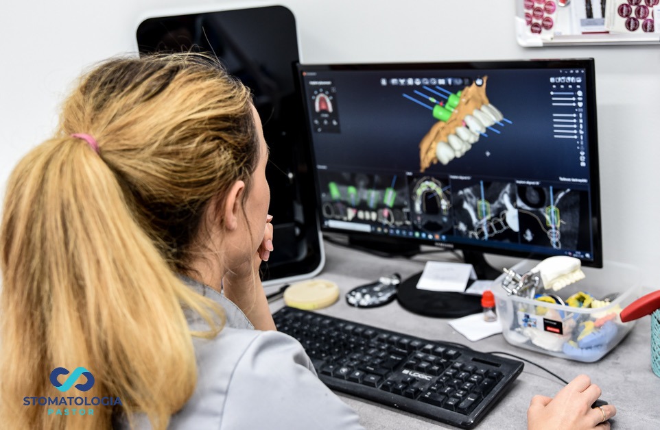 Kobieta z blond włosami w kucyku analizuje na monitorze trójwymiarowy model szczęki z zaznaczonymi implantami, widoczne narzędzia i materiały dentystyczne na biurku.