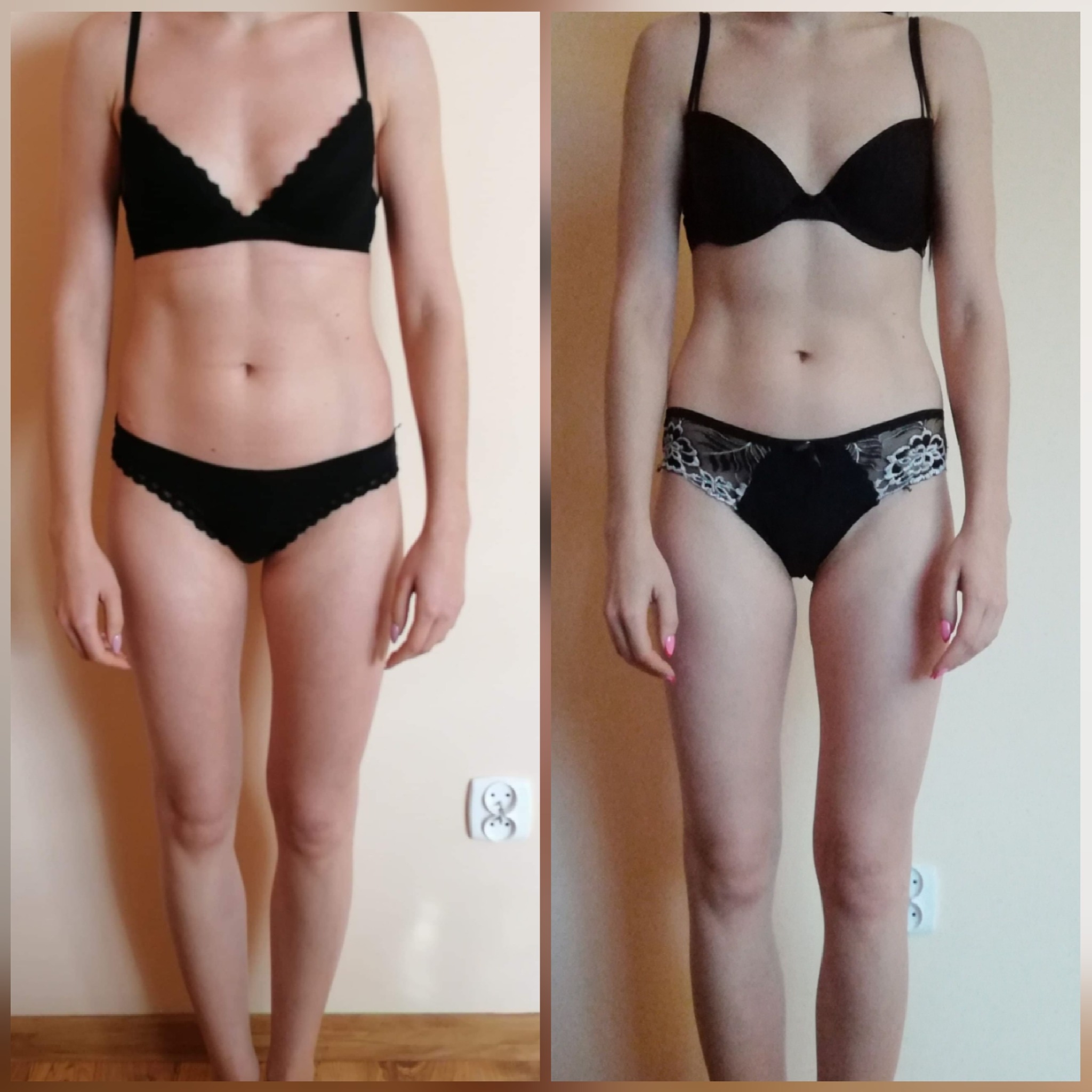 Porównanie sylwetki kobiety przed i po, widoczne zmiany w budowie ciała, szczególnie w okolicy brzucha i ud. Po lewej sylwetka przed, po prawej po. Kobieta ma na sobie czarną bieliznę. Widoczny...