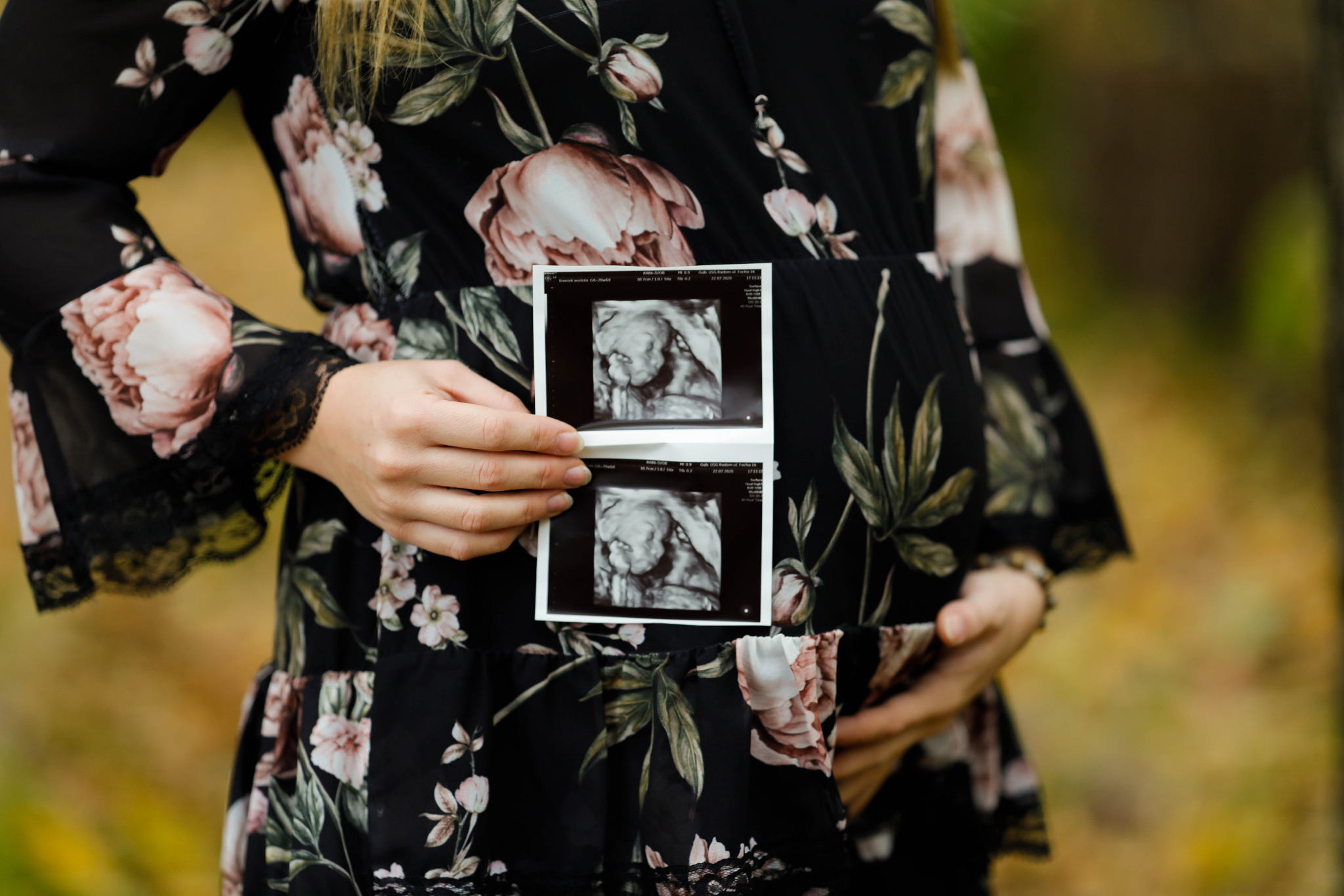 Kobieta w kwiecistej sukience trzymająca zdjęcia USG w dłoniach, delikatnie obejmując brzuch.