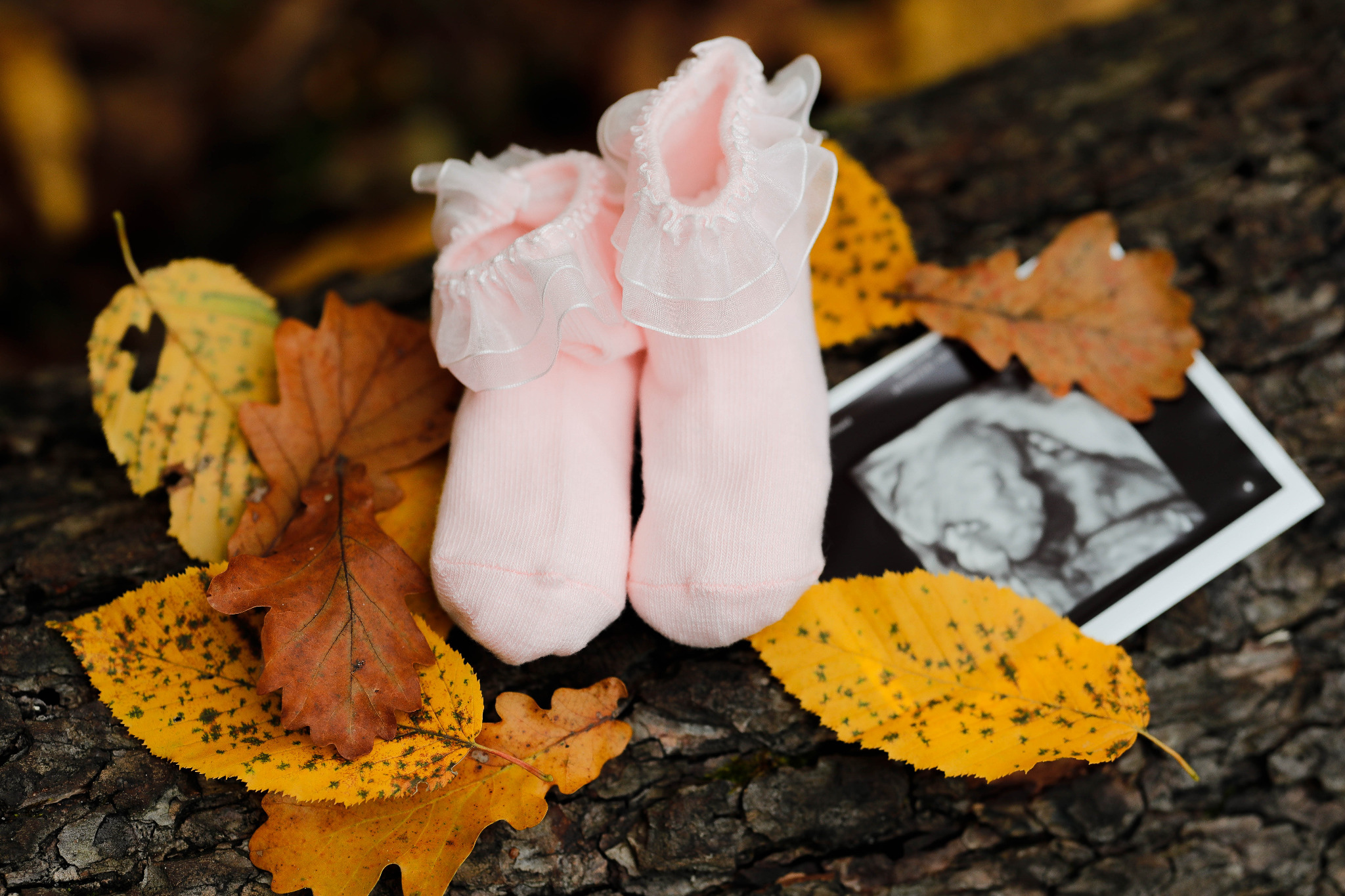 Dwa różowe skarpetki niemowlęce z falbanką, leżące na tle jesiennych liści i zdjęcia USG na korze drzewa.