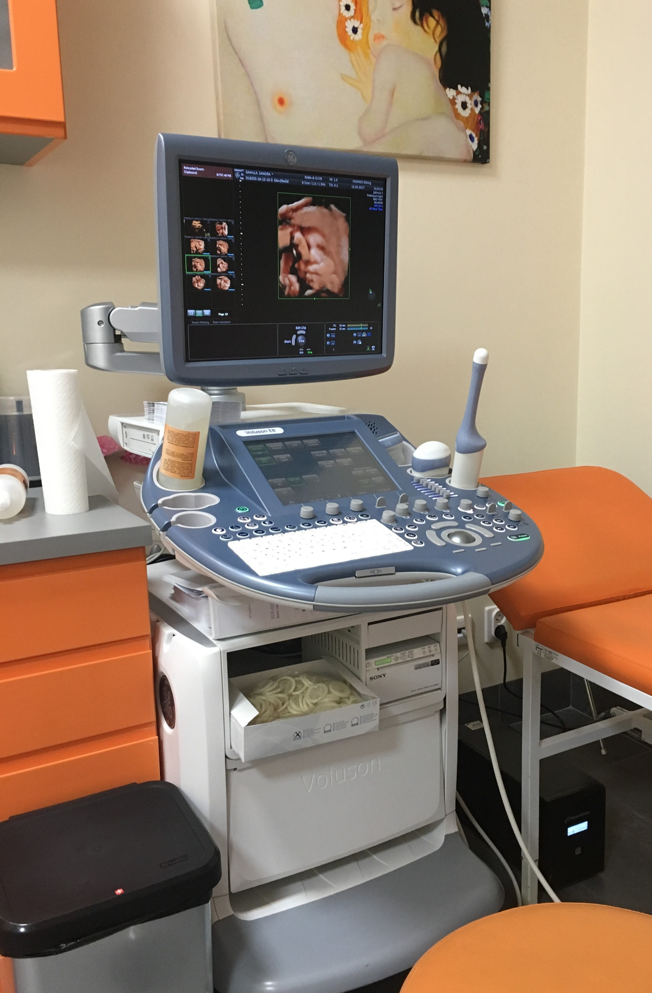 Gabinet ginekologiczny w Elblągu: aparat USG Voluson E8 z widocznym obrazem 3D płodu na ekranie, obok fotel ginekologiczny i obraz na ścianie.
