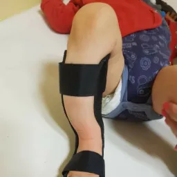 Specjalistyczne ortezy indywidualne dla dzieci i dorosłych.