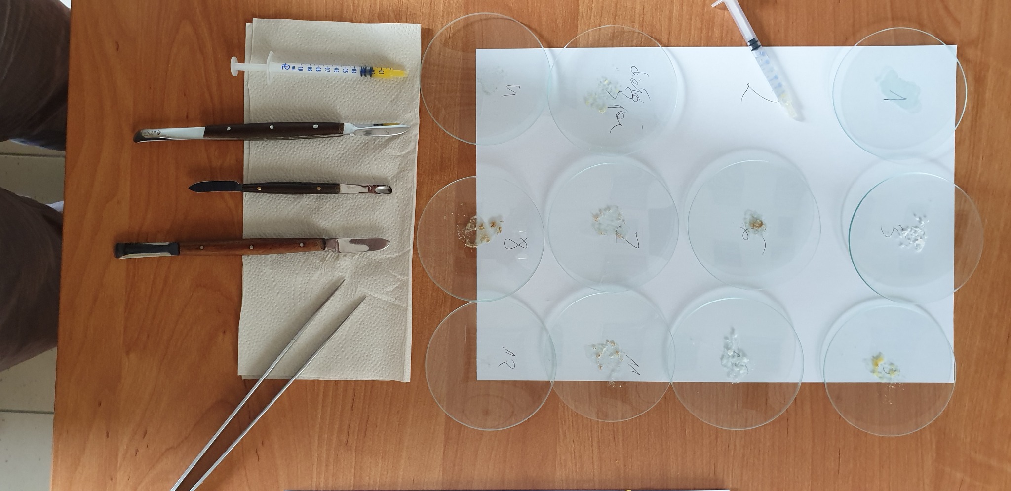 Testy płatkowe pokarmy alergolog Bialystok SIERGIEJKO specjalista