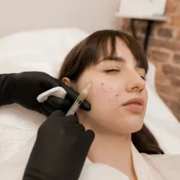 Medycyna estetyczna: osocze bogatopłytkowe, fibryna, toks. botul., kwas hialuronowy i wiele innych.