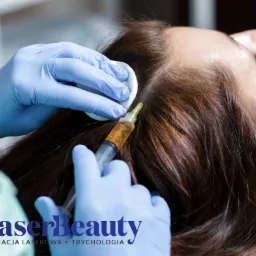 Iniekcja skóry głowy z użyciem strzykawki i preparatu o bursztynowym zabarwieniu, wykonywana przez osobę w niebieskich rękawiczkach; widoczny wacik i fragment brązowych włosów pacjentki.