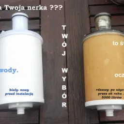 jeżeli pijesz byleco twoja nerka zrobi , oczyści wodę która pijesz