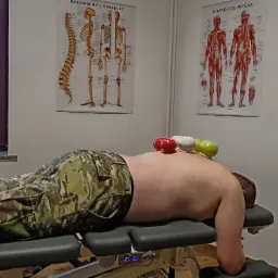 Pacjent leżący na stole do masażu w spodniach moro, na plecach ma bańki chińskie w kolorach czerwonym, białym i zielonym, w tle plakaty z układem mięśni i szkieletem człowieka.