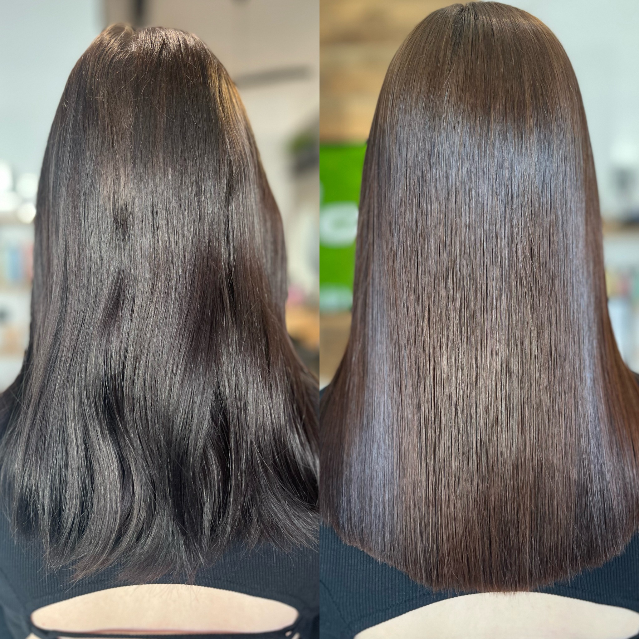 zabieg nanoplastii utrzymuje się 11 miesięcy